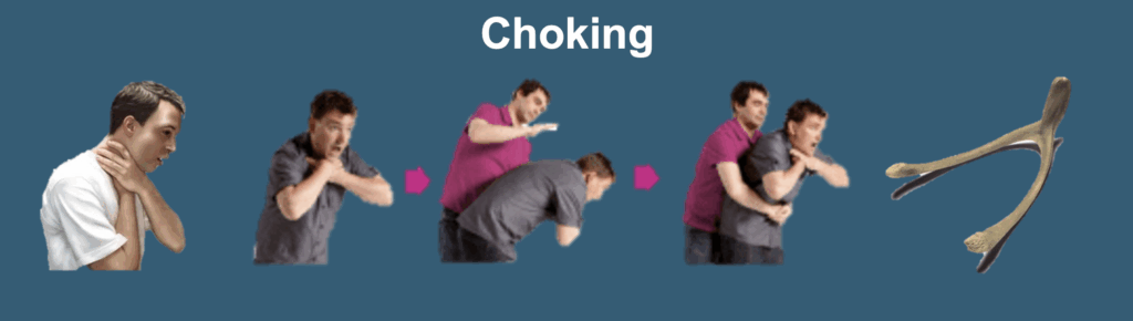 Choking stages image
